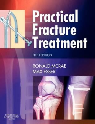 Practical Fracture Treatment - Click Image to Close