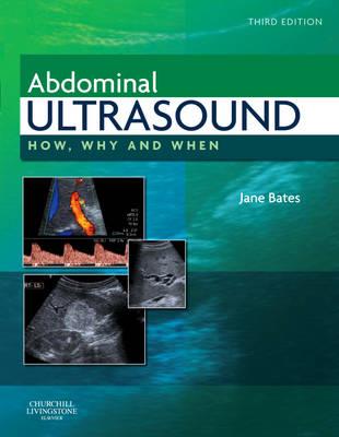 Abdominal Ultrasound - Click Image to Close