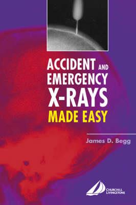 Accident and Emergency X-Rays Made Easy - Click Image to Close