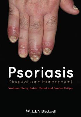 Psoriasis: Diagnosis and Management - Click Image to Close