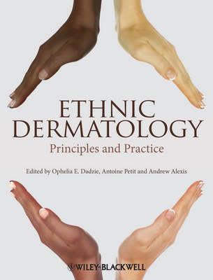 Ethnic Dermatology: Principles and Practice - Click Image to Close