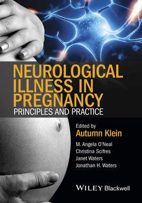 Neurological Illness in Pregnancy: Principles and Practice - Click Image to Close