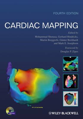Cardiac Mapping - Click Image to Close