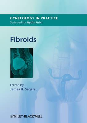 Fibroids - Click Image to Close