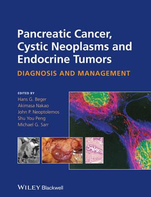 Pancreatic Cancer, Cystic Neoplasms and Endocrine Tumors: Diagnosis and Management - Click Image to Close