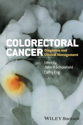 Colorectal Cancer: Diagnosis and Clinical Management - Click Image to Close