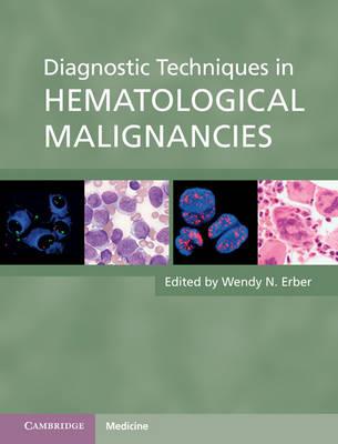 Diagnostic Techniques in Hematological Malignancies - Click Image to Close