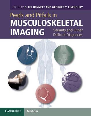 Pearls and Pitfalls in Musculoskeletal Imaging: Variants and Other Difficult Diagnoses - Click Image to Close