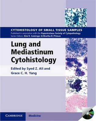 Lung and Mediastinum Cytohistology - Click Image to Close