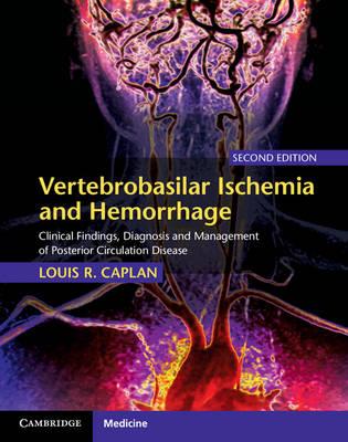 Vertebrobasilar Ischemia and Hemorrhage: Clinical Findings, Diagnosis and Management of Posterior Circulation Disease - Click Image to Close