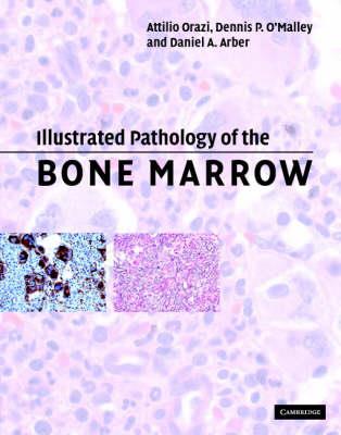 Illustrated Pathology of the Bone Marrow - Click Image to Close