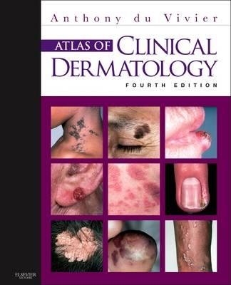 Atlas of Clinical Dermatology - Click Image to Close