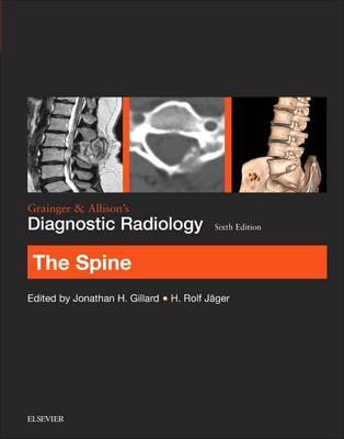 Grainger & Allison's Diagnostic Radiology: The Spine - Click Image to Close