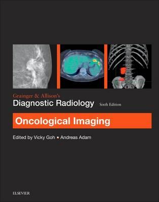 Grainger & Allison's Diagnostic Radiology: Oncological Imaging - Click Image to Close