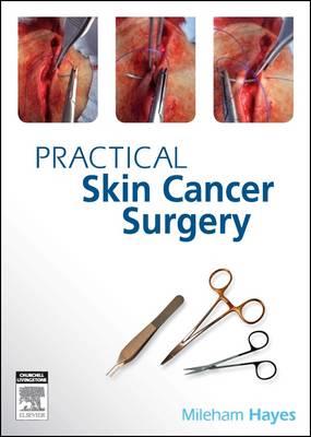 Practical Skin Cancer Surgery: From Fundamentals to Advanced - Click Image to Close