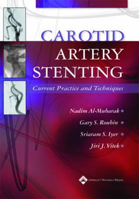 CAROTID ARTERY STENTING - Click Image to Close