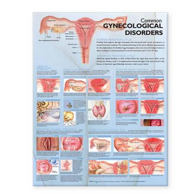 Common Gynecological Disorders Anatomical Chart - Click Image to Close