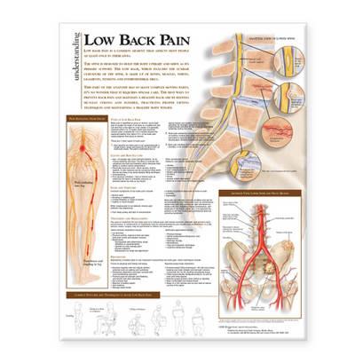 Understanding Low Back Pain Anatomical Chart - Click Image to Close