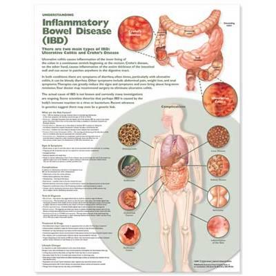 Understanding Inflammatory Bowel Disease (IBD) Anatomical Chart - Click Image to Close