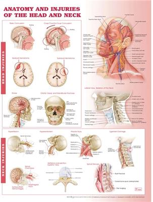 Anatomy and Injuries of the Head and Neck Anatomical Chart - Click Image to Close