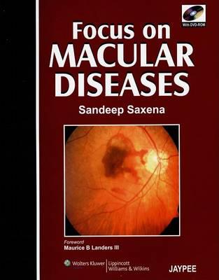 FOCUS MACULAR DISEASES (BOOK+DVD/NTSC) - Click Image to Close