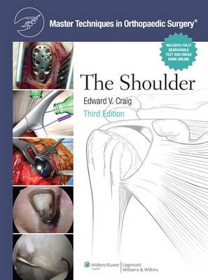Master Techniques in Orthopaedic Surgery: Shoulder - Click Image to Close