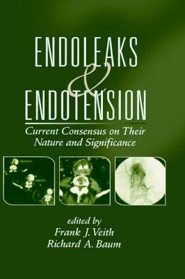 Endoleaks and Endotension - Click Image to Close