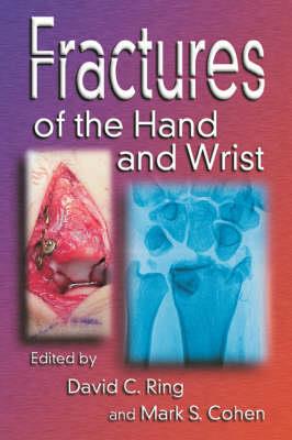 Fractures of the Hand and Wrist - Click Image to Close