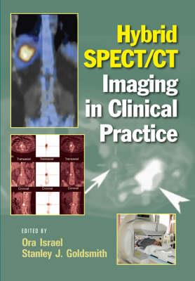 Hybrid SPECT/CT Imaging in Clinical Practice - Click Image to Close