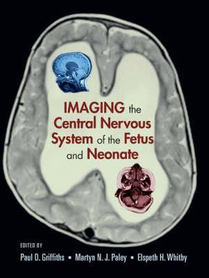 Imaging the Central Nervous System of the Fetus and Neonate - Click Image to Close