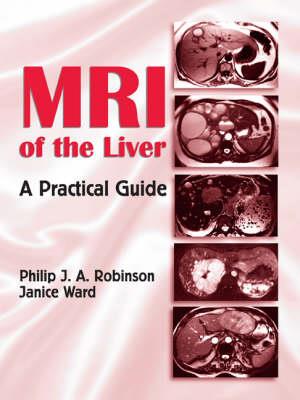 MRI of the Liver - Click Image to Close