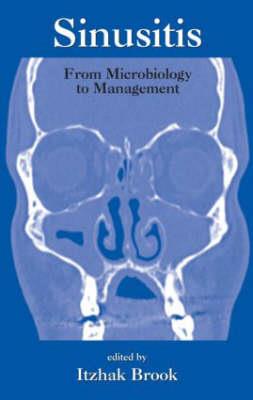 Sinusitis - Click Image to Close