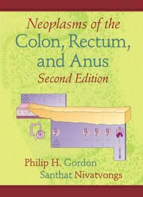 Neoplasms of the Colon, Rectum, and Anus - Click Image to Close