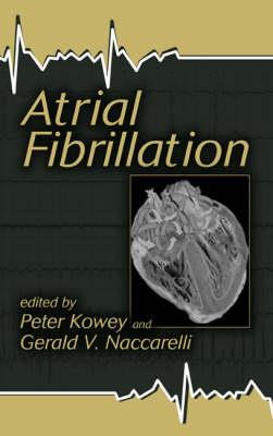 Atrial Fibrillation - Click Image to Close