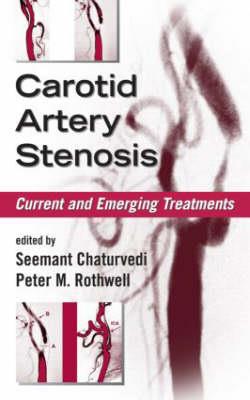 Carotid Artery Stenosis - Click Image to Close