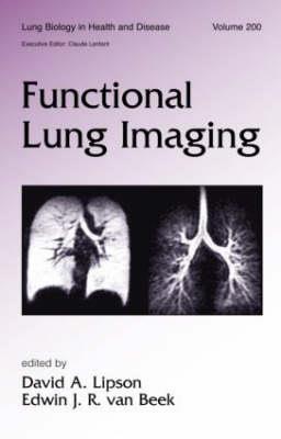 Functional Lung Imaging - Click Image to Close