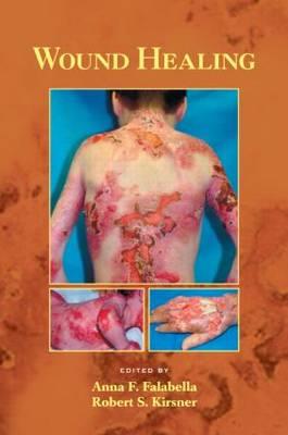 Wound Healing - Click Image to Close