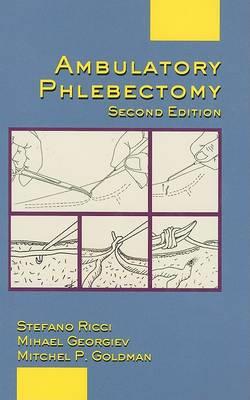 Ambulatory Phlebectomy - Click Image to Close