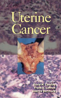 Uterine Cancer - Click Image to Close