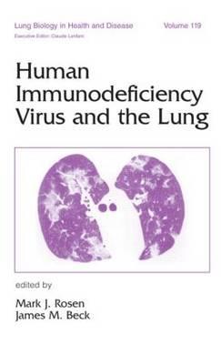 Human Immunodeficiency Virus and the Lung - Click Image to Close