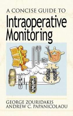 A Concise Guide to Intraoperative Monitoring - Click Image to Close