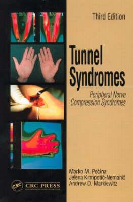 Tunnel Syndromes - Click Image to Close