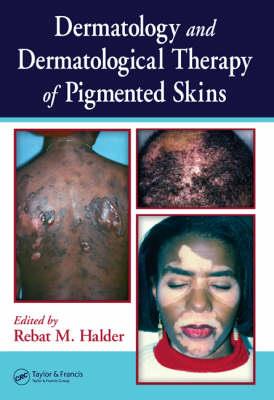 Dermatology and Dermatological Therapy of Pigmented Skins - Click Image to Close