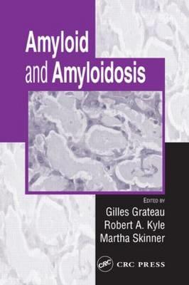 Amyloid and Amyloidosis - Click Image to Close