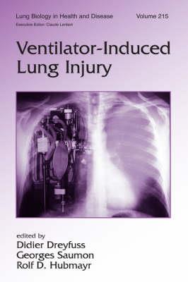 Ventilator-Induced Lung Injury - Click Image to Close