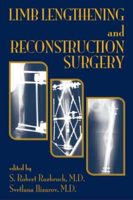 Limb Lengthening and Reconstruction Surgery - Click Image to Close