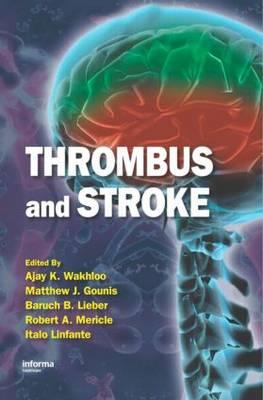 Thrombus and Stroke - Click Image to Close