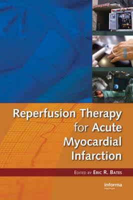 Reperfusion Therapy for Acute Myocardial Infarction - Click Image to Close