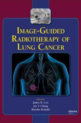 Image-Guided Radiotherapy of Lung Cancer - Click Image to Close