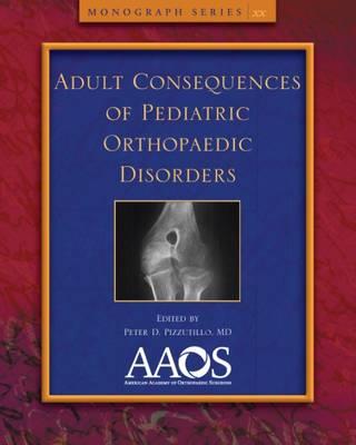 Adult Consequences of Pediatric Orthopaedic Disorders - Click Image to Close